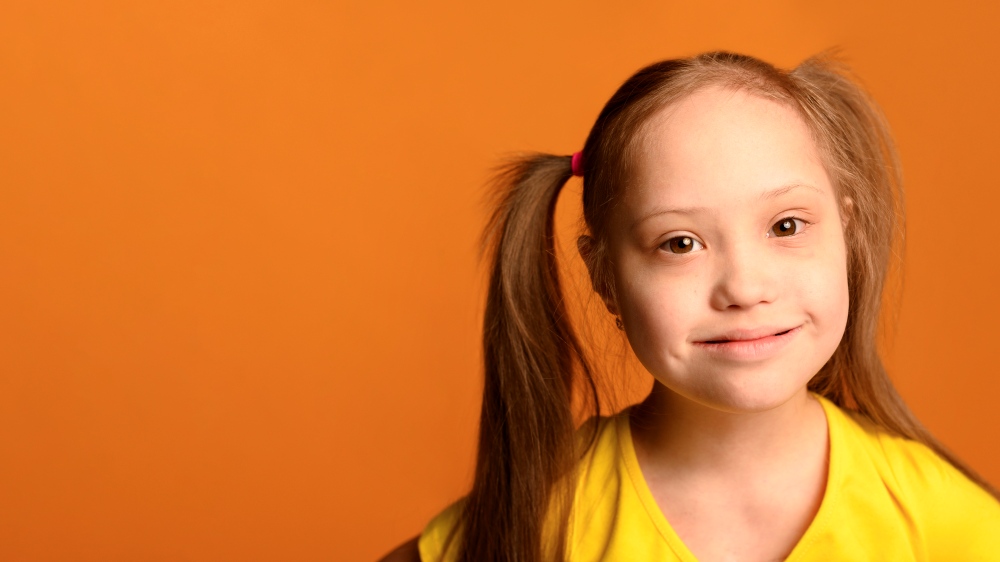 Niña con Síndrome de Angelman sonriendo felizmente, mostrando la alegría de vivir a pesar de los desafíos del trastorno.